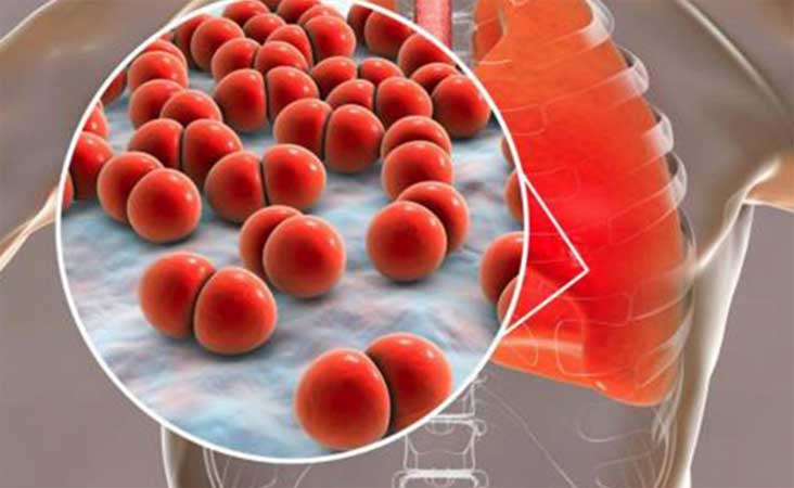 Cuba, vacuna, Quimi-vio, bacteria, resistente