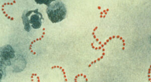 Streptococcus_pyogenes_bacteria